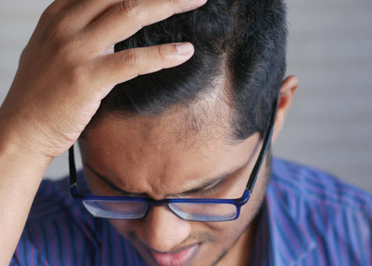 How to Prevent Clumping When Using Black Hair Fibres