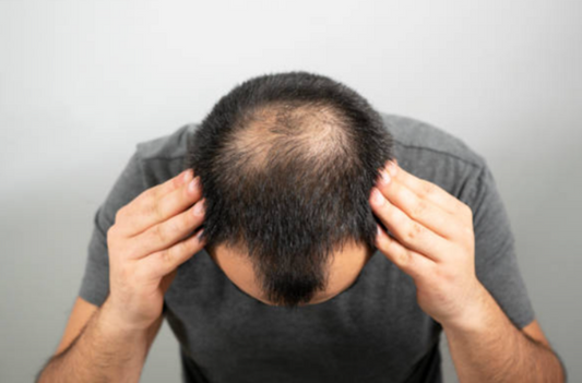 How to Get Instant Salon-Quality Hair with Black Hair Fibres and Hair Fibres Powder?